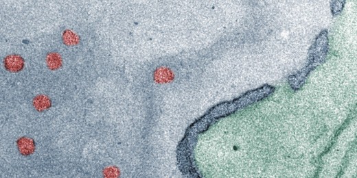 Um in den Zellkern (grau) zu gelangen, müssen die Polymersomen (rot) die Kernmembran (dunkelblau) durch die Kernporenporenkomplexe (Lücken in der Kernmembran) passieren.